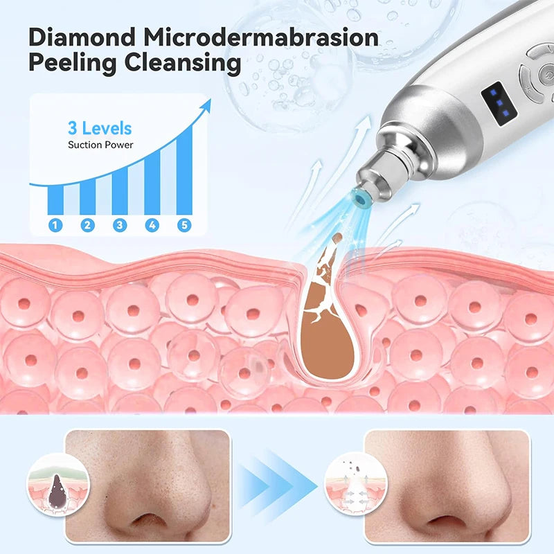 Portable Diamond Microdermabrasion Device